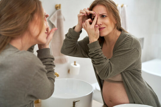 Is Acne Common During Early Pregnancy